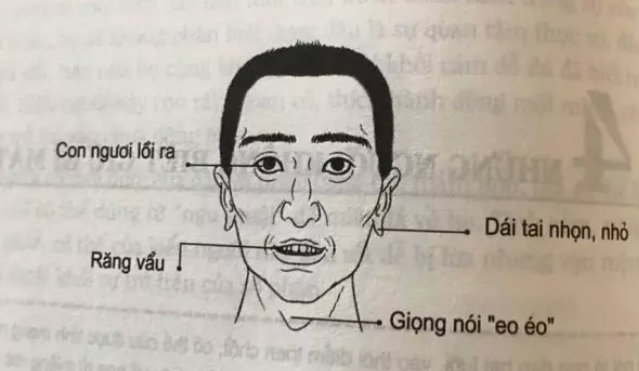 Nhìn mặt mà bắt hình dong: 4 tướng người càng thân càng mất lộc, 3 tướng mặt có quý nhân giúp đỡ